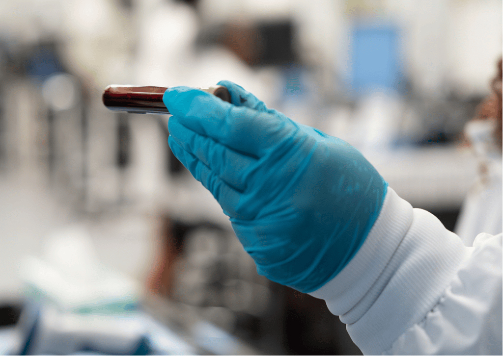 mced-blood-test-vial-1024x726.png